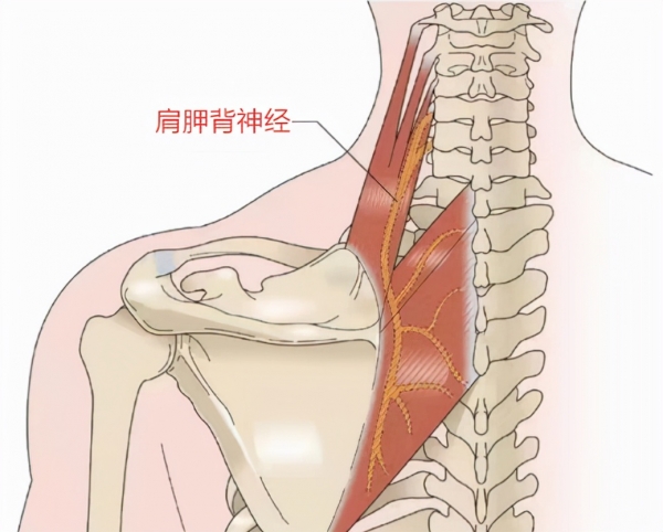 总是后背疼痛别不当回事小心是这三种癌(图11)